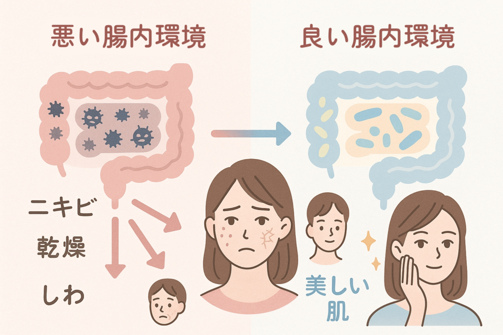腸内環境の良し悪し