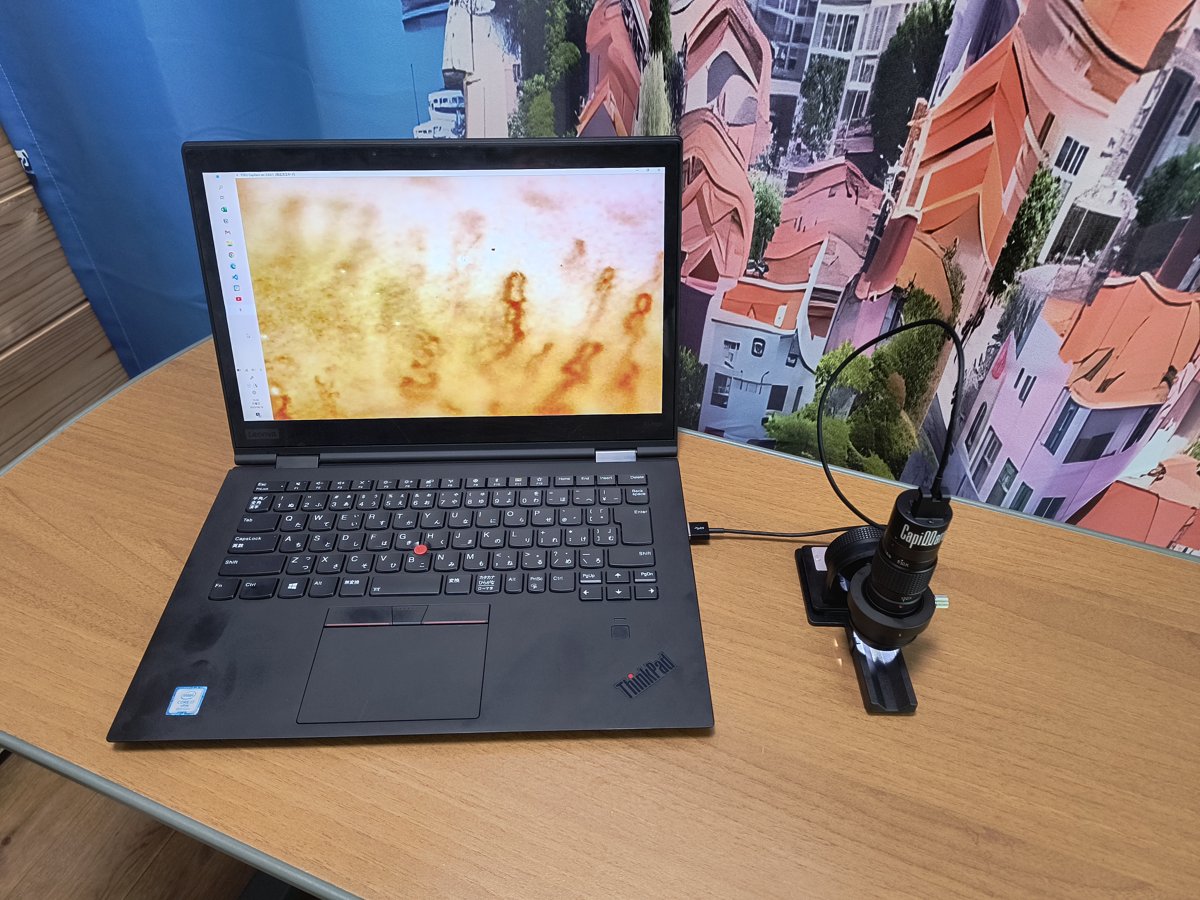 パソコンにつないで使う毛細血管スコープ